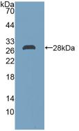 Polyclonal Antibody to Dimethylarginine Dimethylaminohydrolase 2 (DDAH2)