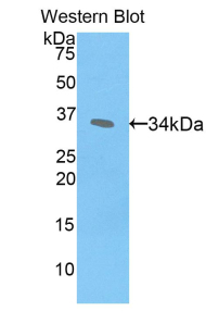 Polyclonal Antibody to CREB Binding Protein (CREBBP)