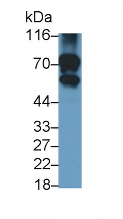 Polyclonal Antibody to Neurofilament, Light Polypeptide (NEFL)