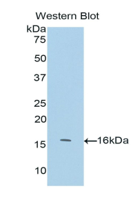 Polyclonal Antibody to Neurofilament, Light Polypeptide (NEFL)