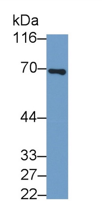 Polyclonal Antibody to Neurofilament, Light Polypeptide (NEFL)