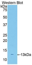 Polyclonal Antibody to Neurofilament, Light Polypeptide (NEFL)