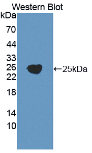 Polyclonal Antibody to Gamma-Glutamyltransferase 5 (gGT5)