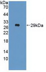 Polyclonal Antibody to Interferon Alpha/Beta Receptor 2 (IFNa/bR2)