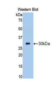 Polyclonal Antibody to Elastase 3B (ELA3B)