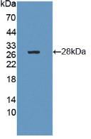 Polyclonal Antibody to Chymotrypsinogen B1 (CTRB1)