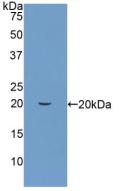 Polyclonal Antibody to Peptidyl Prolyl Cis/Trans Isomerase NIMA Interacting Protein 1 (PIN1)