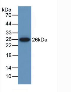 Polyclonal Antibody to Muscle, Skeletal, Receptor Tyrosine Kinase (MUSK)