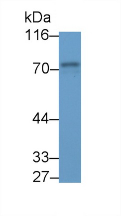 Polyclonal Antibody to Spleen Tyrosine Kinase (SYK)