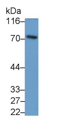 Polyclonal Antibody to Spleen Tyrosine Kinase (SYK)