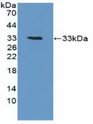 Polyclonal Antibody to Protein Tyrosine Kinase 6 (PTK6)