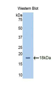 Polyclonal Antibody to Solute Carrier Family 3, Member 2 (SLC3A2)