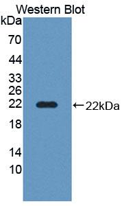 Polyclonal Antibody to Na-Cl Cotransporter (NCCT)