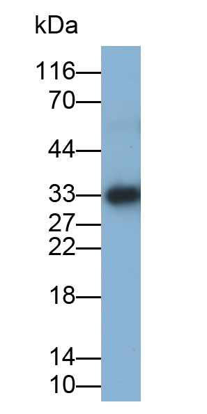 Polyclonal Antibody to Sodium/Glucose Cotransporter 2 (SGLT2)