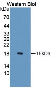 Polyclonal Antibody to Organic Cation/Ergothioneine Transporter (OCTN1)