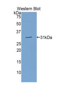 Polyclonal Antibody to Electron Transfer Flavoprotein Alpha Polypeptide (ETFa)