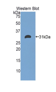 Polyclonal Antibody to Electron Transfer Flavoprotein Alpha Polypeptide (ETFa)