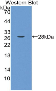 Polyclonal Antibody to Endothelial Cell Adhesion Molecule (ESAM)