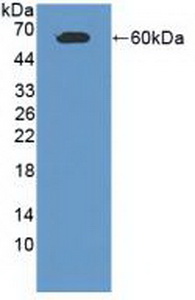 Polyclonal Antibody to Cell Adhesion Molecule 1 (CADM1)