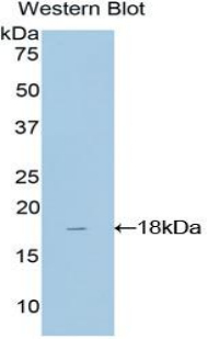 Polyclonal Antibody to TATA Box Binding Protein Associated Factor 13 (TAF13)