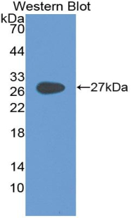 Polyclonal Antibody to Glycoprotein 2, Zymogen Granule Membrane (GP2)