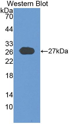 Polyclonal Antibody to Glycoprotein 2, Zymogen Granule Membrane (GP2)