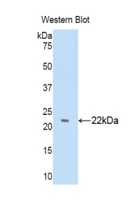 Polyclonal Antibody to Alpha-1-B-Glycoprotein (a1BG)