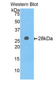 Polyclonal Antibody to Alpha-1-B-Glycoprotein (a1BG)