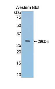 Polyclonal Antibody to Alpha-1-B-Glycoprotein (a1BG)