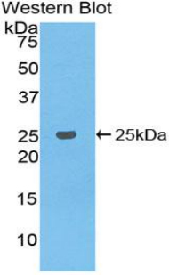 Polyclonal Antibody to B-Cell CLL/Lymphoma 2 Like Protein (Bcl2L)