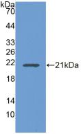 Polyclonal Antibody to Ubiquitin Conjugating Enzyme E2L3 (UBE2L3)