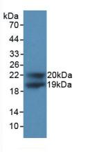 Polyclonal Antibody to Cyclin Dependent Kinase Inhibitor 1A (CDKN1A)