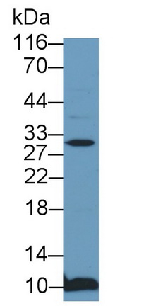 Polyclonal Antibody to Cyclin Dependent Kinase Inhibitor 1B (CDKN1B)