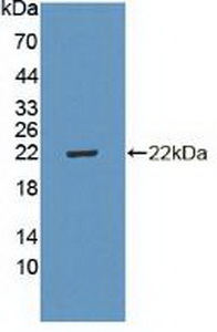 Polyclonal Antibody to Cyclin Dependent Kinase Inhibitor 2D (CDKN2D)