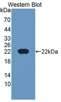 Polyclonal Antibody to Cyclin Dependent Kinase Inhibitor 2D (CDKN2D)