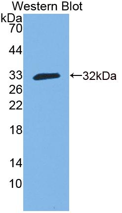 Polyclonal Antibody to Guanylate Binding Protein 3 (GBP3)