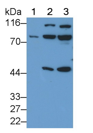 Polyclonal Antibody to Receptor Interacting Serine Threonine Kinase 1 (RIPK1)