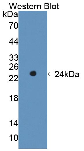 Polyclonal Antibody to Receptor Interacting Serine Threonine Kinase 1 (RIPK1)