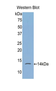 Polyclonal Antibody to FK506 Binding Protein 1A (FKBP1A)