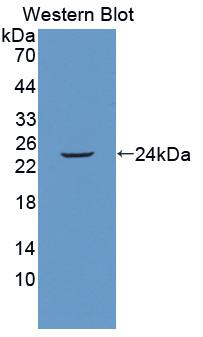 Polyclonal Antibody to FK506 Binding Protein 7 (FKBP7)