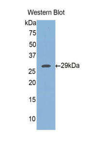 Polyclonal Antibody to FK506 Binding Protein 8 (FKBP8)