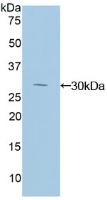 Polyclonal Antibody to Inhibitory Subunit Of NF Kappa B Delta (IkBd)