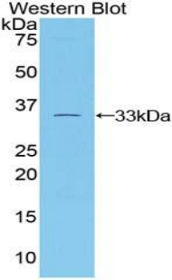 Polyclonal Antibody to Tubulin Beta 1 (TUBb1)