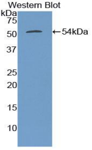 Polyclonal Antibody to Tubulin Beta 3 (TUBb3)