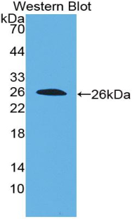 Polyclonal Antibody to Interleukin 22 Receptor Alpha 2 (IL22Ra2)