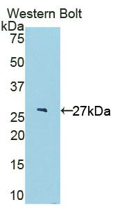 Polyclonal Antibody to Interleukin 22 Receptor Alpha 2 (IL22Ra2)