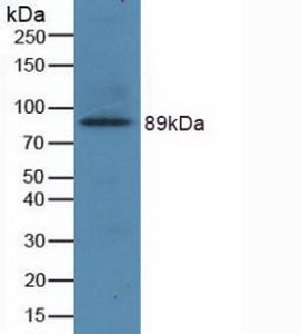 Polyclonal Antibody to Glutamate Receptor, Ionotropic, N-Methyl-D-Aspartate 2B (GRIN2B)