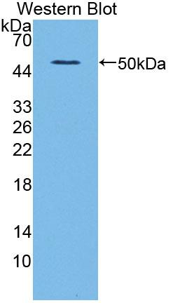 Polyclonal Antibody to Aldehyde Dehydrogenase 1 Family, Member A2 (ALDH1A2)