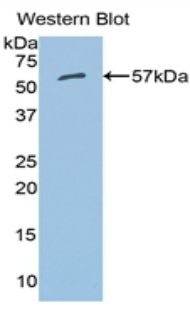 Polyclonal Antibody to Aldehyde Dehydrogenase 7 Family, Member A1 (ALDH7A1)