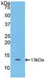 Polyclonal Antibody to Catenin Beta Interacting Protein 1 (CTNNbIP1)